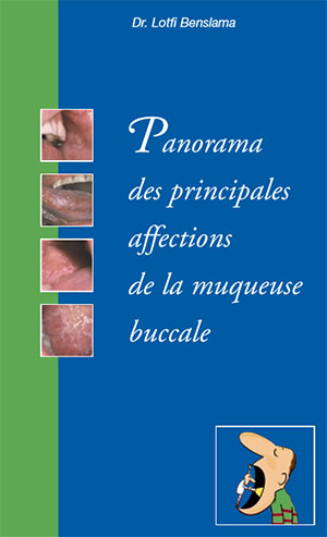 Dr. Lotfi Benslama, publication Panorama des principales affections de la muqueuse buccale