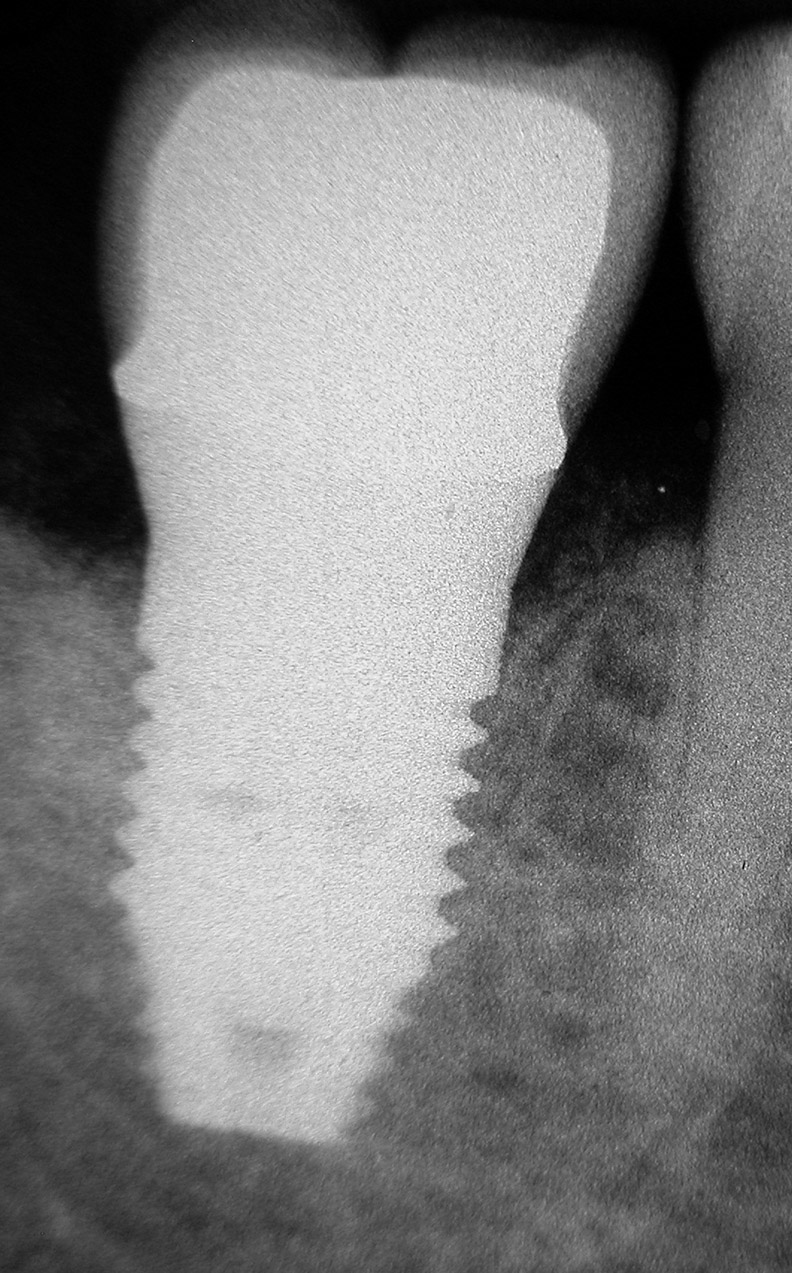 contrôle radiographique