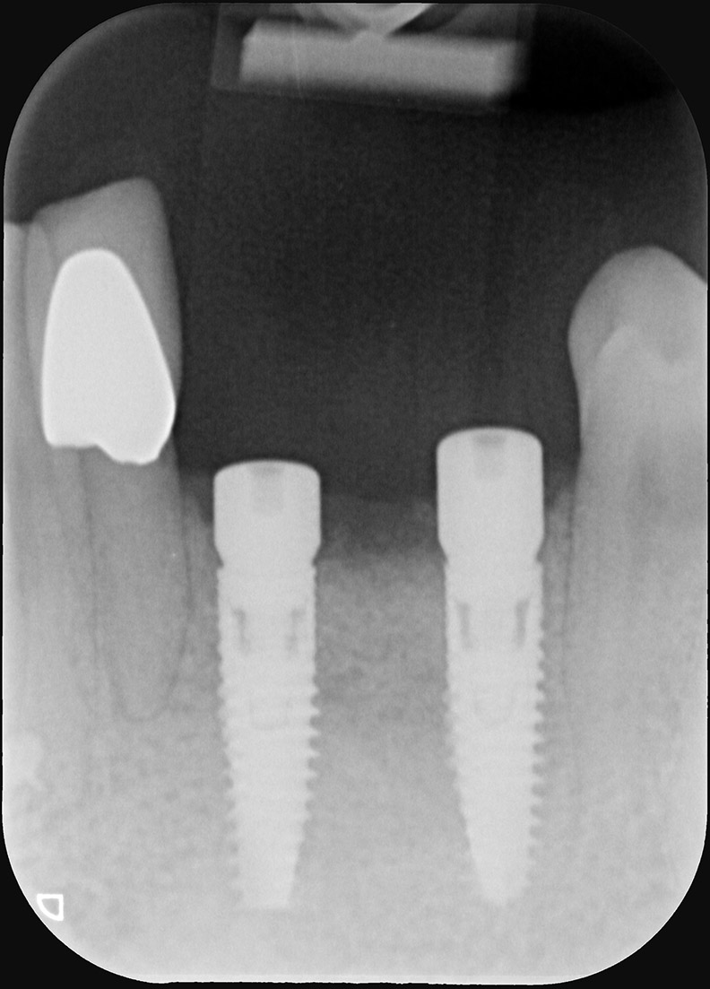 contrôle radiographique